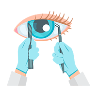 Polo anterior, cirugía de cataratas y glaucoma