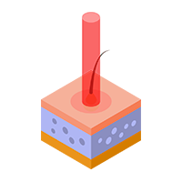 Depilación Láser Diodo